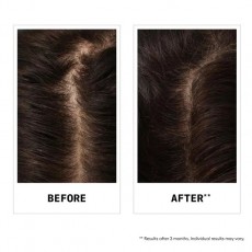 Nioxin Anti Hair Loss Shampoo 240ml Nioxin Anti Hair Loss Shampoo 240ml